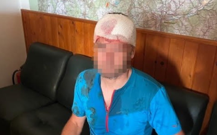 Na záchranára na Donovaloch zaútočil medveď. Hlavu si však zranil sám pri páde