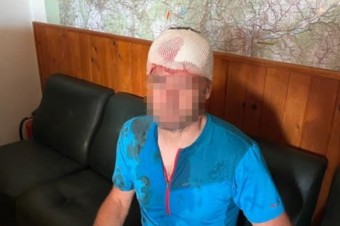 Na záchranára na Donovaloch zaútočil medveď. Hlavu si však zranil sám pri páde