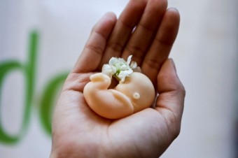 Texaské obmedzenie potratov viedlo k vyššiemu počtu pôrodov, ukázala štúdia