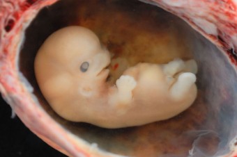V laboratóriu vytvorili syntetické ľudské embryá. Čo to pre nás znamená?