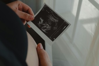 O čom nie je súčasný spor o potratoch
