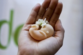 Po Alabame prijali zákon proti interrupciám aj v Missouri