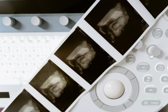 Kľúčové hlasovanie na Floride nebolo úspešné, sedem štátov však zakotvilo právo na potrat do svojich ústav