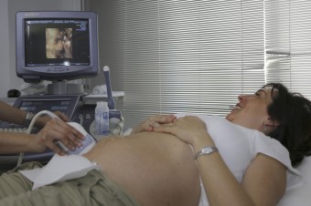 Profesori práva i medicíny sa postavili proti. „Nerešpektujete najnovšie poznatky prenatálnej medicíny!“