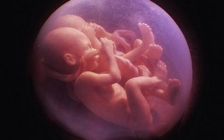 Slovenské hnutie pro-choice zatiaľ o americkom škandále mlčí