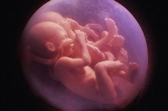 Slovenské hnutie pro-choice zatiaľ o americkom škandále mlčí