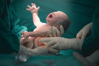 Na Slovensku sa narodilo dieťa, ktoré operovali pre rázštep chrbtice ešte v maternici