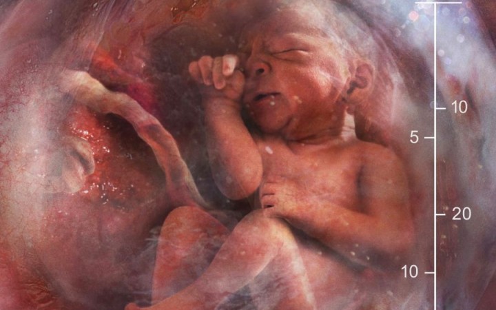 Neuroveda posúva svoje poznanie tak, že môže zmeniť právny pohľad na potraty