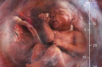 Neuroveda posúva svoje poznanie tak, že môže zmeniť právny pohľad na potraty