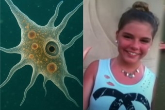 Améby v USA prežilo niekoľko detí. V Česku sa nakazilo 16 ľudí v jednom bazéne a všetci zomreli