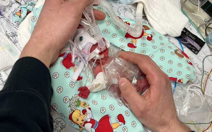 Lekári dokážu udržať pri živote čoraz menšie predčasne narodené deti. Vyrieši medicínsky pokrok dilemu okolo potratov?