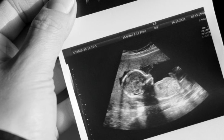 Dokument odhalil, že muži darujú spermie aj mimo dozoru kliník. Nikto nevie, koľko detí takto splodili