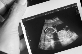 Dokument odhalil, že muži darujú spermie aj mimo dozoru kliník. Nikto nevie, koľko detí takto splodili