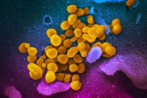 Unikol vírus SARS-CoV-2 predsa len z čínskeho laboratória?