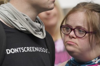 Žena s Downovým syndrómom prehrala v Británii súd o interrupčný zákon