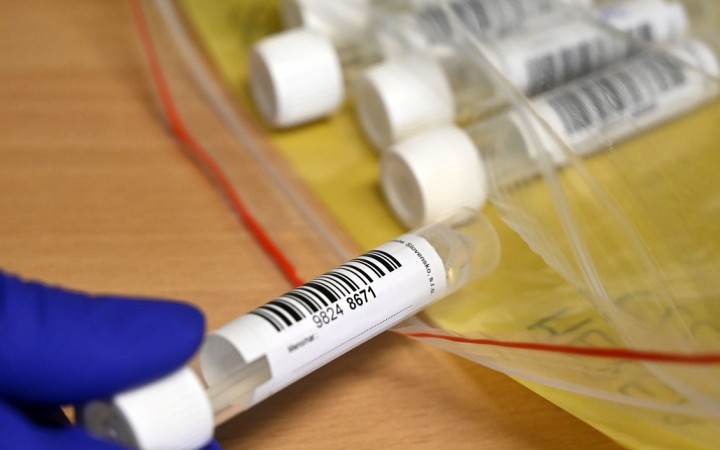 Viac ako polovica neočkovaných na Slovensku nemá protilátky proti covidu