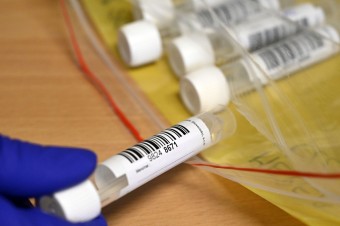 Viac ako polovica neočkovaných na Slovensku nemá protilátky proti covidu